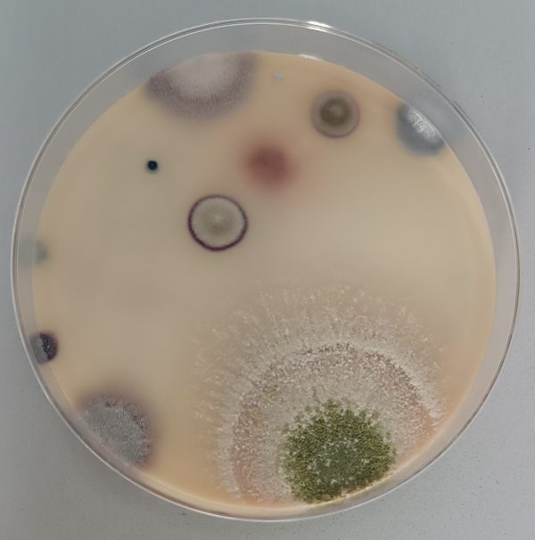 bacteria on the microscope